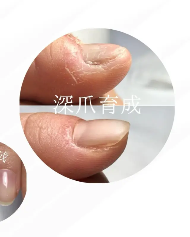 @riche.nail でサロン情報更新中💅🏻

📍柏駅徒歩5分｜深爪・自爪育成ネイルサロン Riche（リッシェ）です✨

【爪の育成を軸にリニューアル💅🏻】
Richeは今年10周年を迎えます😊
2018年から取り組んできた「深爪・自爪育成」を軸に
爪にお悩みがある方を対象にもっと深い、
根本的な部分からサポートできるよう新メニューを導入いたします✨

⭐️新メニュー

①トラブルネイル
ーーーーーーーーーーーーーーーーーーーーーーーー
☑︎重度の深爪で悩んでいる方
☑︎爪の剥離や凹凸のボコボコした爪でお悩みの方
☑︎この状態でネイルサロンに行っていいのかな？とお悩みの方

などを対象に、
身体の内側からの影響も考えながら整えるコースです😊

ーーーーーーーーーーーーーーーーーーーーーーーー

②剥がせるジェルネイル
ーーーーーーーーーーーーーーーーーーーーーーーー
☑︎剥がしてオフができる新感覚のピールオフジェル
☑︎結婚式やイベントの時だけネイルがしたいという方
☑︎オフの際に削って出るダストが気になるという方
☑︎妊婦さんや急に病院に行く可能性がある方

などに向いている
自分でも簡単にオフが出来るジェルネイル💅🏻
ーーーーーーーーーーーーーーーーーーーーーーーー

今までの自爪育成・上品ネイルをベースに
もっともっとネイルを楽しめる方が増えたらと
新しいメニューを導入することにしました☺️

①のトラブルネイルコースに関しましては
6月末からモニター募集を開始する予定です。

気になる方はLINE登録して
『トラブルネイルモニター」と
トークに送ってください✨

詳細をお送りさせていただきます！

📩 公式LINEは
→ @riche.nail のプロフィール下リンクより

📌サロン情報
深爪・自爪育成ネイルサロン Riche（リッシェ）

〒277-0841
千葉県柏市あけぼの4-4-5 コンフォート203
柏駅西口徒歩5分｜完全予約制

定休日：水曜・木曜